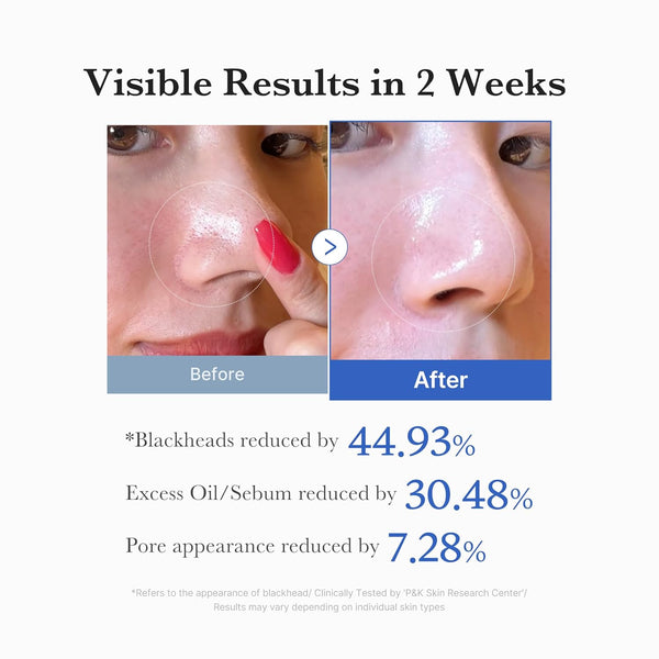 Zero Pore Exfoliating Pads
