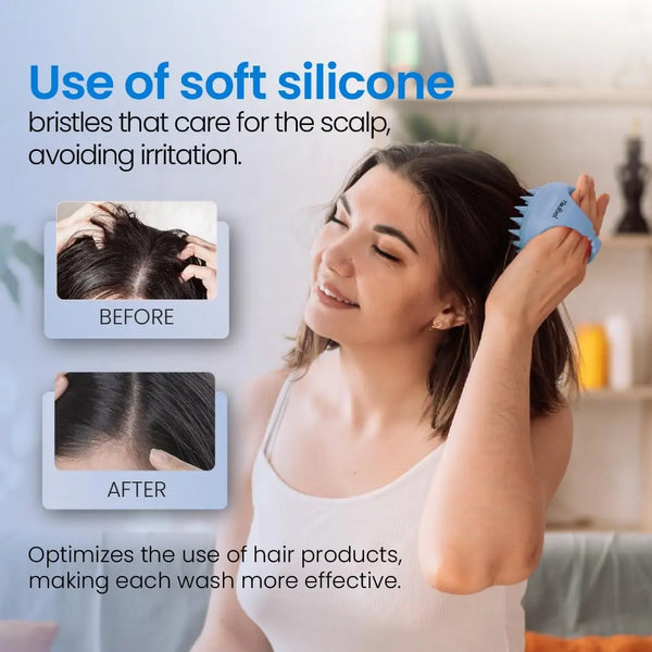 Hair-Scalp-Massager-Shampoo-Brush-Scalp-Exfoliator-for-Dandruff-Removal-for-Hair-Growth-Wet-Dry-Scalp.jpg